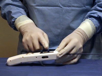 Viper™ Catheter in the hands of a doctor